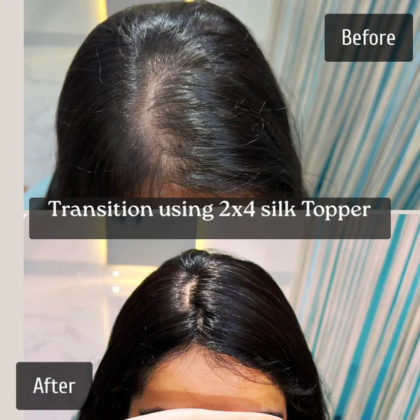 100% Real Human Hair Scalp Topper (2x4)