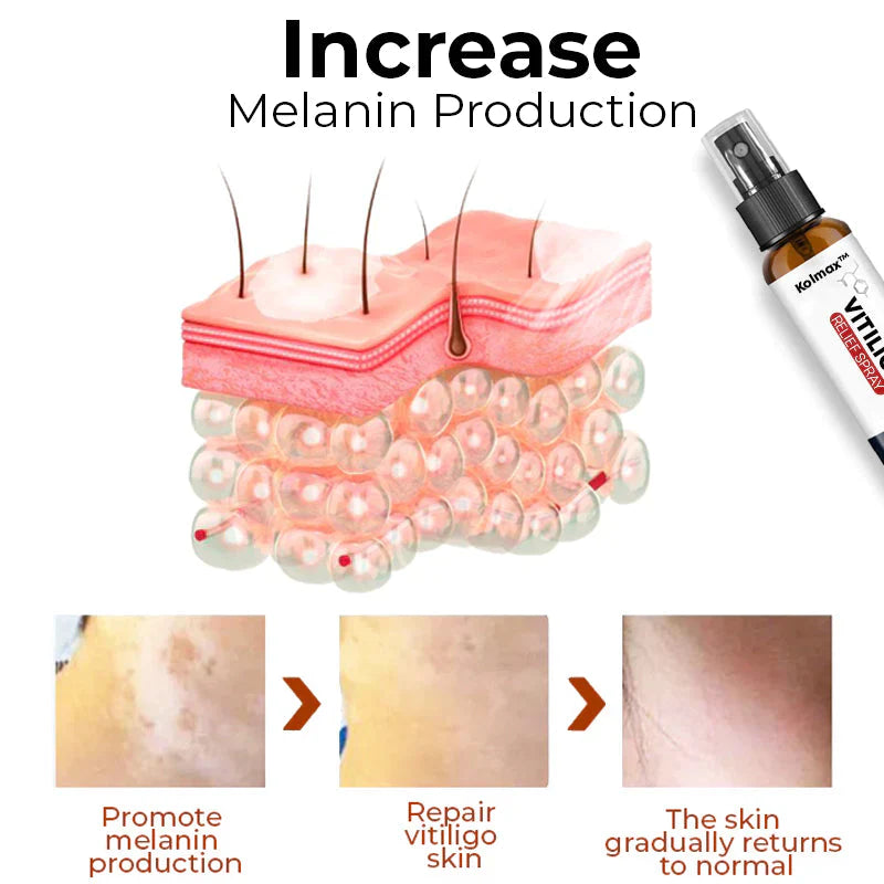 Kolmax Vitiligo Relief Spray