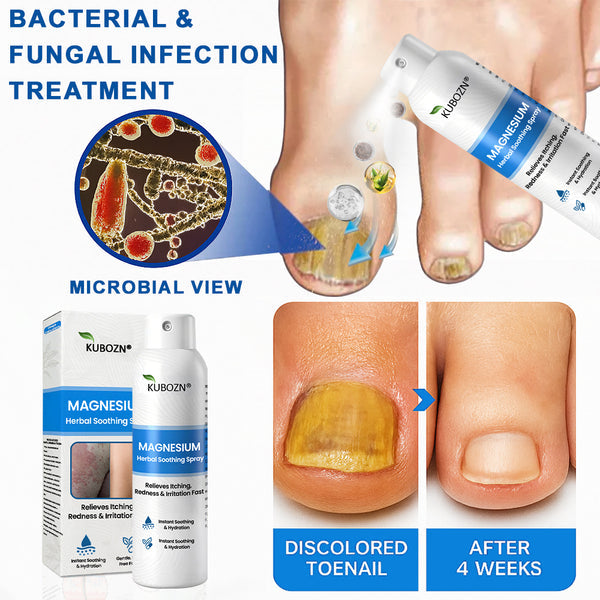 ✅ Official Store: KUBOZN® Magnesium Herbal Psoriasis Spray 👨‍⚕️ MHRA Approved (Relieves psoriasis and eczema, improves bacterial infections in the genital area, treats acne and warts)