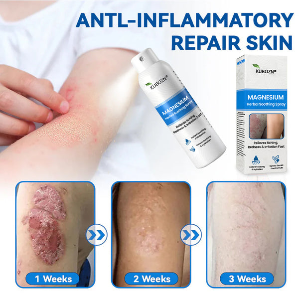 ✅ Official Store: KUBOZN® Magnesium Herbal Psoriasis Spray 👨‍⚕️ MHRA Approved (Relieves psoriasis and eczema, improves bacterial infections in the genital area, treats acne and warts)