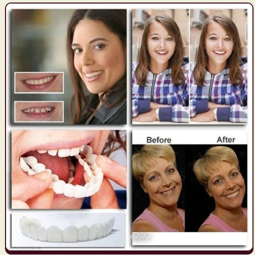 🎉 Last day discount🦷 💝 75% discount 👨‍⚕ Adjustable snap-on dentures 😁