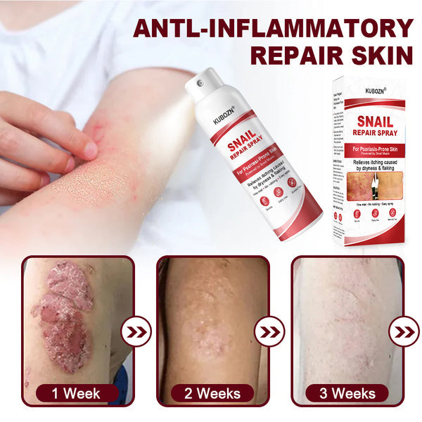 🔥KUBOZN® Snail Repair Spray for Itchy, Flaky Psoriasis Skin🛡️【Imported from the UK】
